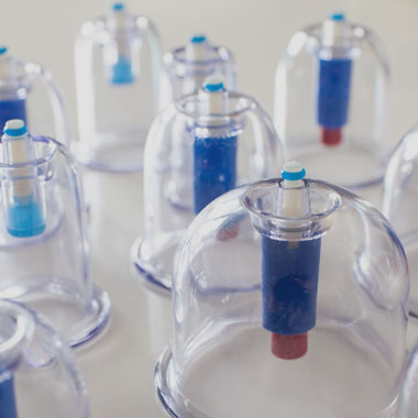 Bryony also does cupping therapy!